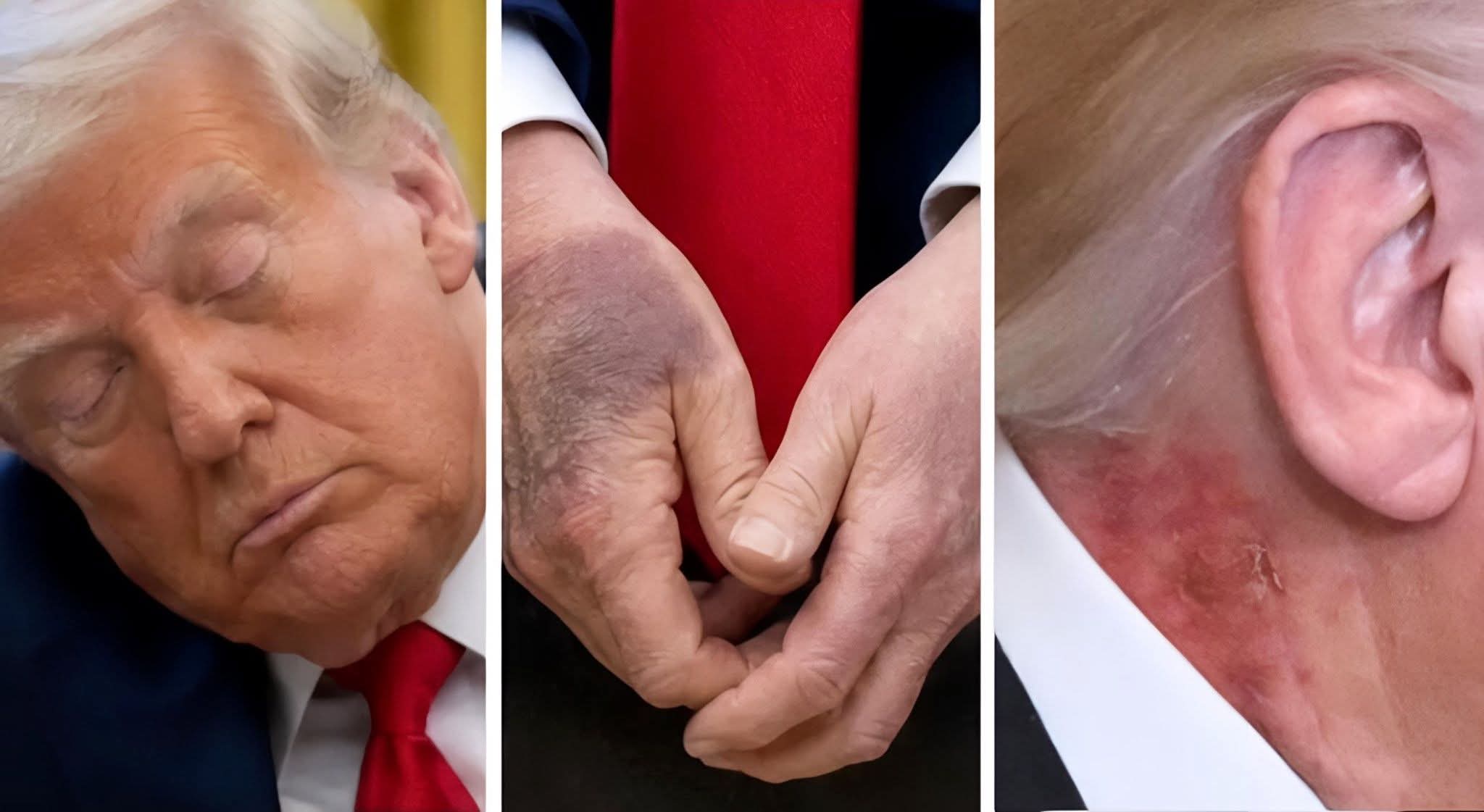 BOMBSHELL REVEAL: Trump's Secret Illness Accidentally Leaked with Classified Epstein Files – White House in Chaos
