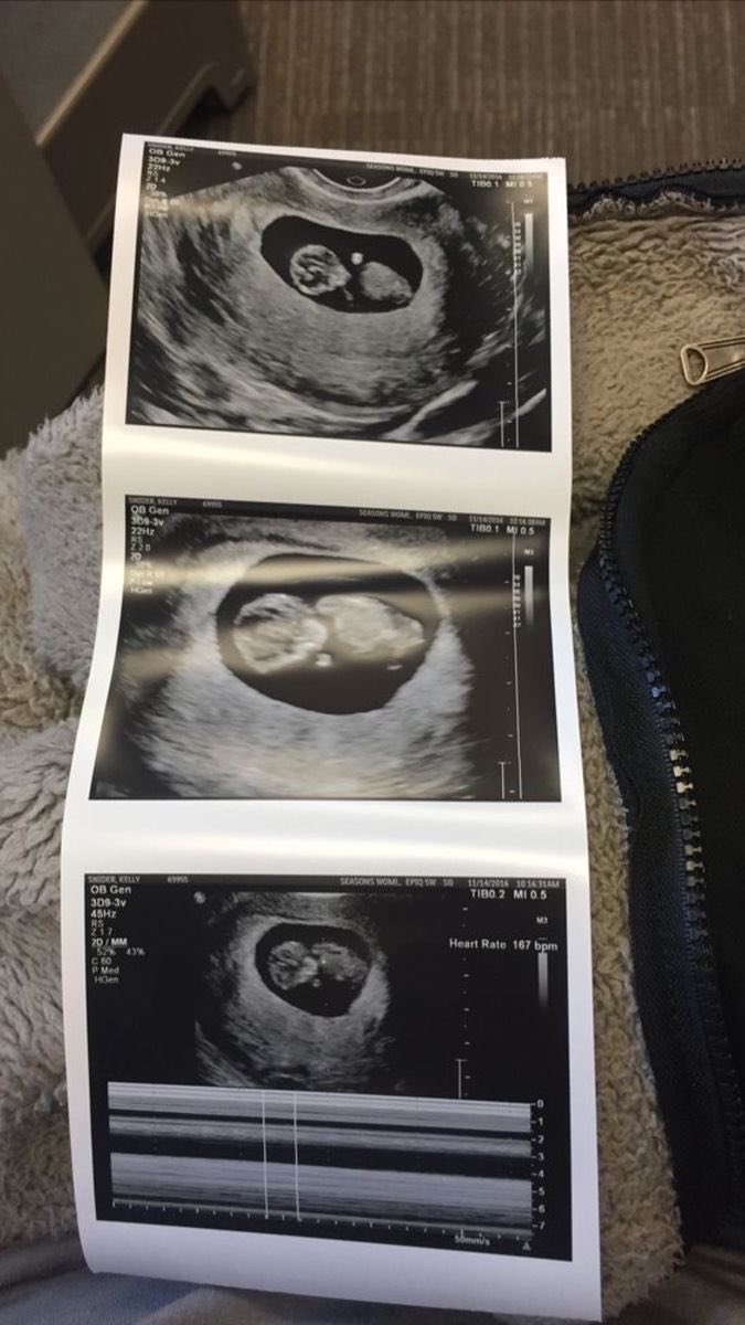 Just 3 Days After Their Wedding, Taylor Swift Goes Live to Reveal She’s Pregnant With Twins — Shares Emotional Message About Motherhood and Even Teases Their Names… See More