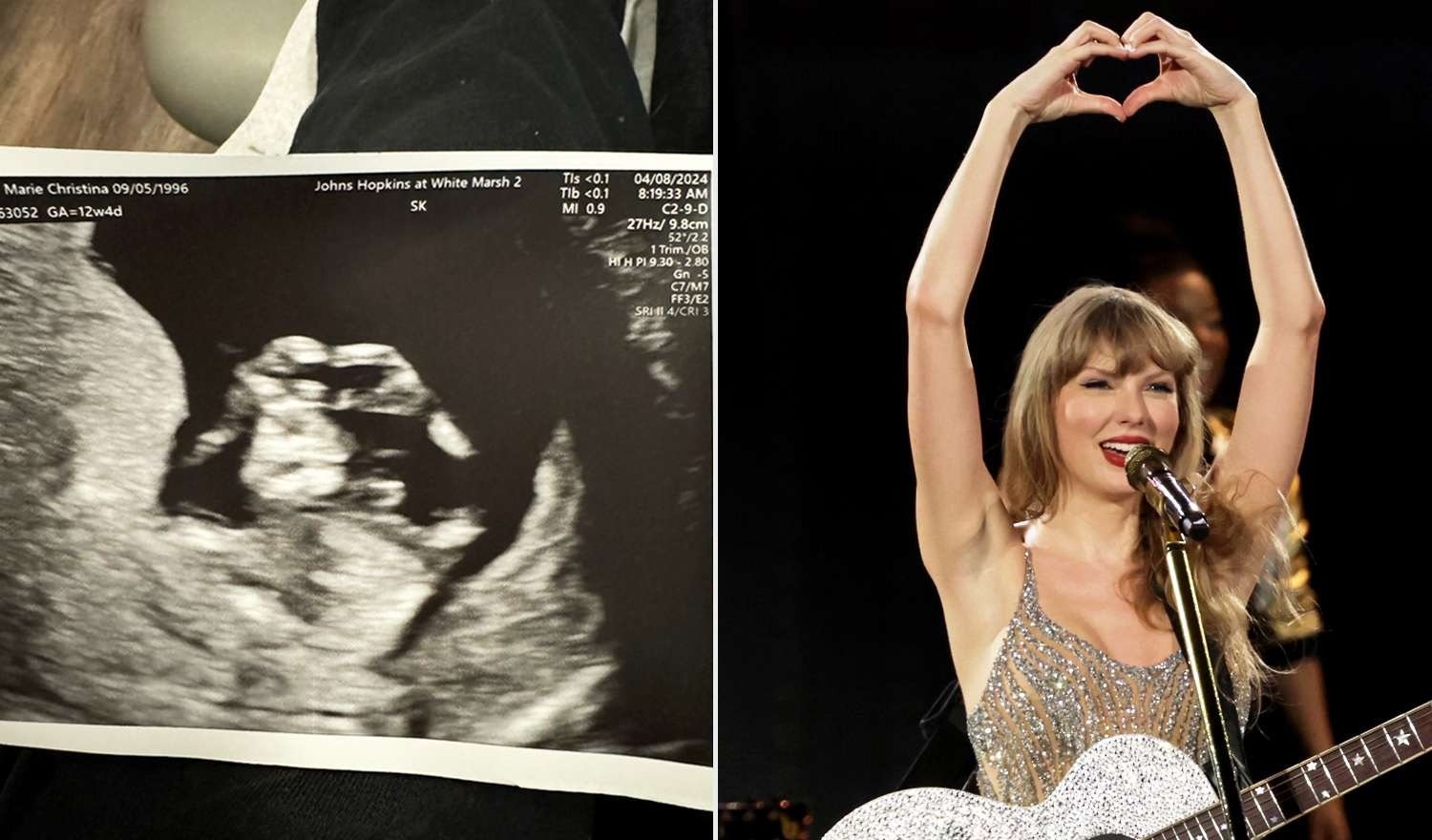 Test confirmed Taylor Swift Is Pregnant For Travis Kelce But Not Ready to be a Mother until When Married Officially 