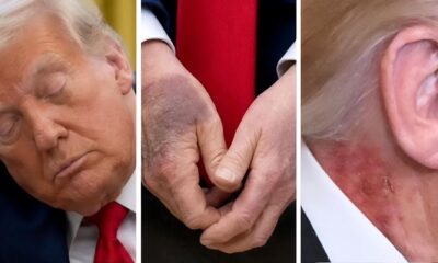 BOMBSHELL REVEAL: Trump's Secret Illness Accidentally Leaked with Classified Epstein Files – White House in Chaos